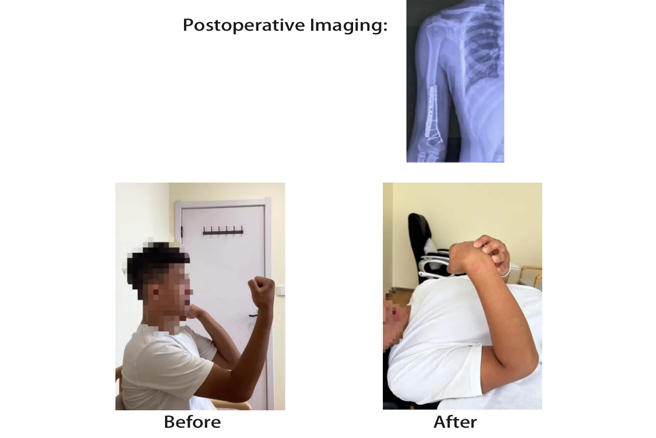 Infortuni sportivi（immagini 3）