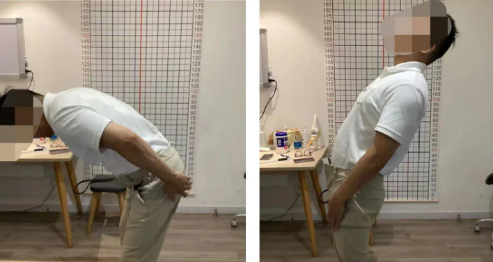 High-Power Laser Therapy for Acute Lumbar Sprain（images 1）