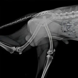 High Power Laser Improves Postoperative Rehabil...