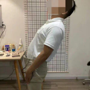 治疗急性腰扭伤的高功率激光疗法