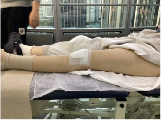 العلاج بالليزر لاضطراب وظيفة الركبة بعد الجراحة في حالات التهاب الفقار اللاصق: تقرير حالة (الصورة 1)