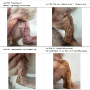 Veterinary Laser Therapy Of Secondary Tibiofibu...