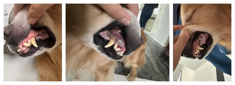 Case Sharing | Application of Class 4 Laser Therapy in Treating Gingival Hyperplasia with Chronic Inflammation（images 2）
