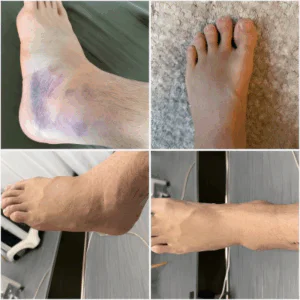 Application of Laser Therapy in Rehabilitation ...