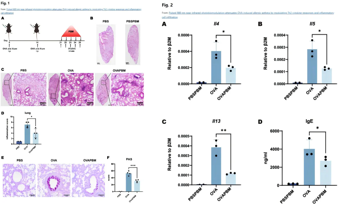 Fotonmedix Medical Laser Breakthrough Published in a Nature Sub-Journal:The World’s First Decoding of the Laser Therapy Mechanism for Asthma and Pneumonia(images 6)
