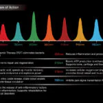 Infographic: a spectrum of laser wavelengths from 450 nm to 1064 nm with labeled color bars and descriptions of their therapeutic effects.自主移动机器人