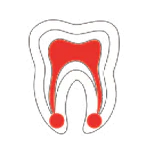 التهاب لب السن القابل للشفاء